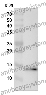 Anti-KISS1 Polyclonal Antibody