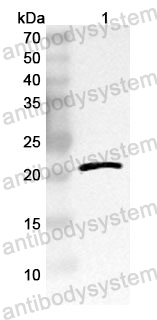 Anti-MYLK Polyclonal Antibody