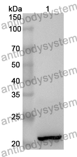 Anti-Human SLC1A5 Polyclonal Antibody