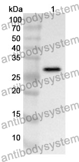 Anti-NPTX1 Polyclonal Antibody