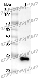 Anti-Human CHRNA6 Polyclonal Antibody