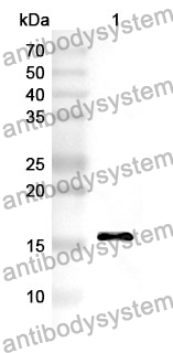 Anti-CST6 Polyclonal Antibody