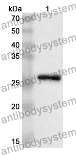 Anti-Adiponectin/ACRP30/ADIPOQ Polyclonal Antibody