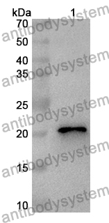 Anti-Human SCN9A Polyclonal Antibody