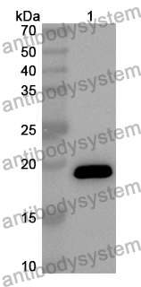 Anti-EZH2 Polyclonal Antibody