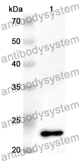 Anti-ZYX Polyclonal Antibody