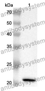 Anti-HSPB2 Polyclonal Antibody