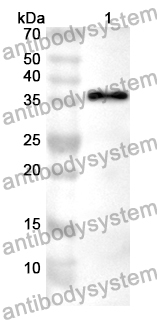 Anti-Human E2F4 Polyclonal Antibody