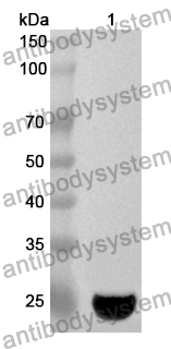 Anti-PSMD5 Polyclonal Antibody