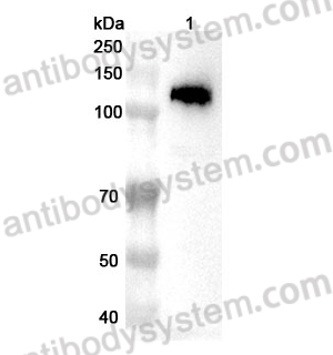 Anti-PKN1 Polyclonal Antibody