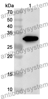 Anti-PKN2 Polyclonal Antibody