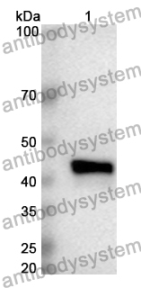 Anti-Human ASIC2 Polyclonal Antibody