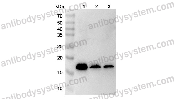 Anti-Human MRPL23 Polyclonal Antibody