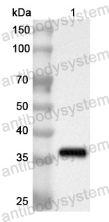 Anti-Human RBBP7 Polyclonal Antibody