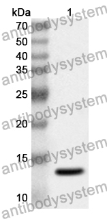 Anti-CALCRL Polyclonal Antibody