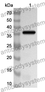 Anti-Human ECM1 Polyclonal Antibody