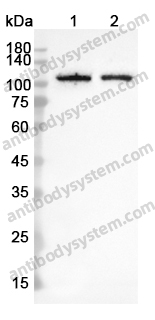 Anti-TrkB /NTRK2 Polyclonal Antibody