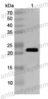 Anti-Human SRSF7 Polyclonal Antibody