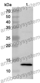 Anti-Human CPSF6 Polyclonal Antibody