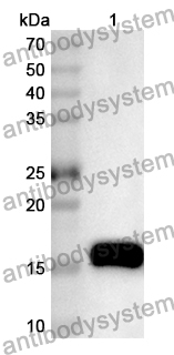 Anti-Drebrin 1/DBN1 Polyclonal Antibody