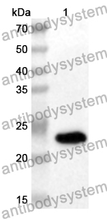 Anti-Human TBR1 Polyclonal Antibody