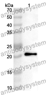 Anti-Human NRF1 Polyclonal Antibody