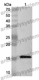 Anti-FSCN1 Polyclonal Antibody