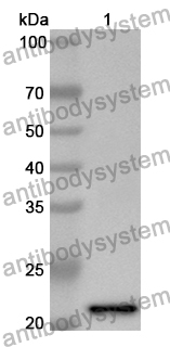 Anti-Human NDUFA5 Polyclonal Antibody