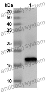 Anti-Human UGCG Polyclonal Antibody