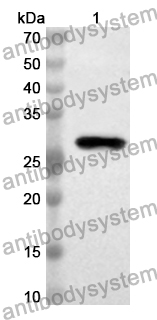 Anti-Human CLPP Polyclonal Antibody