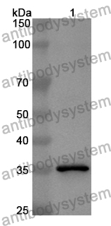 Anti-TST Polyclonal Antibody