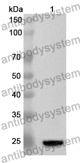 Anti-UBE2S Polyclonal Antibody