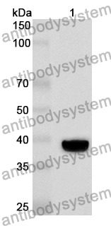 Anti-QPCT Polyclonal Antibody