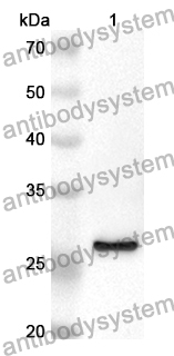 Anti-GSTA3 Polyclonal Antibody