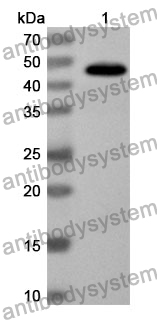 Anti-KYAT1 Polyclonal Antibody