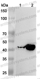 Anti-KYAT1 Polyclonal Antibody