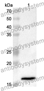 Anti-HIST2H2BE/H2BC21 Polyclonal Antibody