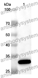 Anti-Human LAMA3 Polyclonal Antibody