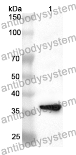 Anti-Human PTPRO Polyclonal Antibody