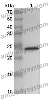 Anti-CDO1 Polyclonal Antibody