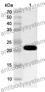 Anti-Human TPD52L1 Polyclonal Antibody