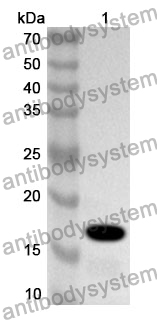 Anti-Human CSPP1 Polyclonal Antibody