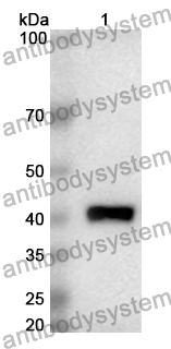 Anti-Human KIF7 Polyclonal Antibody