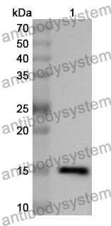 Anti-RSPO1 Polyclonal Antibody