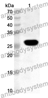 Anti-Human ATG2A Polyclonal Antibody