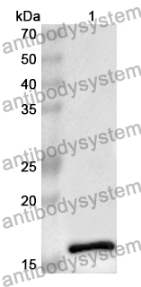 Anti-LGALS9B Polyclonal Antibody