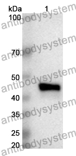 Anti-Human ALDH1L2 Polyclonal Antibody