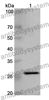 Anti-Human TIMM50 Polyclonal Antibody