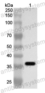 Anti-Human VPS26B Polyclonal Antibody