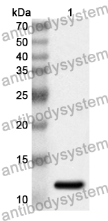 Anti-ANO6 Polyclonal Antibody